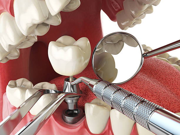 Best Emergency Broken Tooth Repair in Pilot Rock, OR